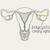 What Is PCOS? Signs, Causes, and How to Manage Polycystic Ovary Syndrome
